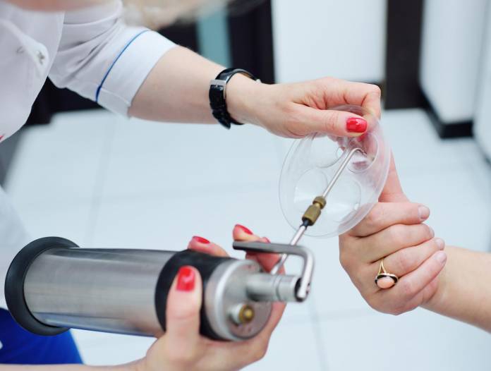 Kryotherapie von Warzen