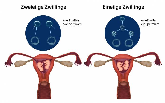 Eineiige und zweieiige Zwillinge