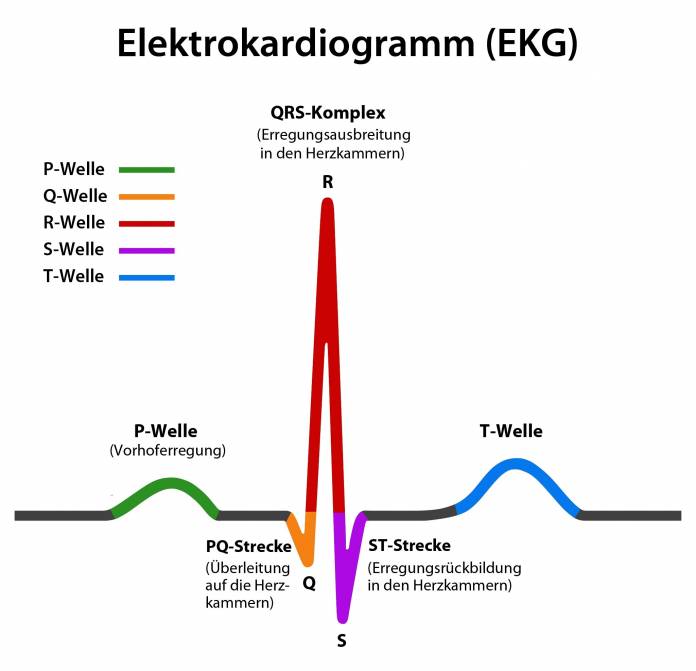 Elektrokardiogramm (EKG)