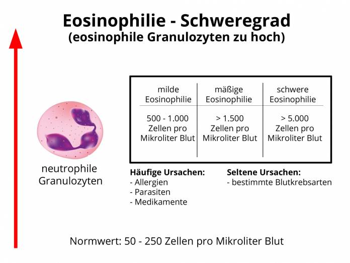 Eosinophilie