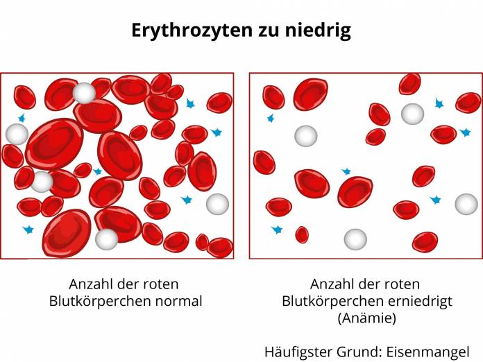 Erythrozyten zu niedrig