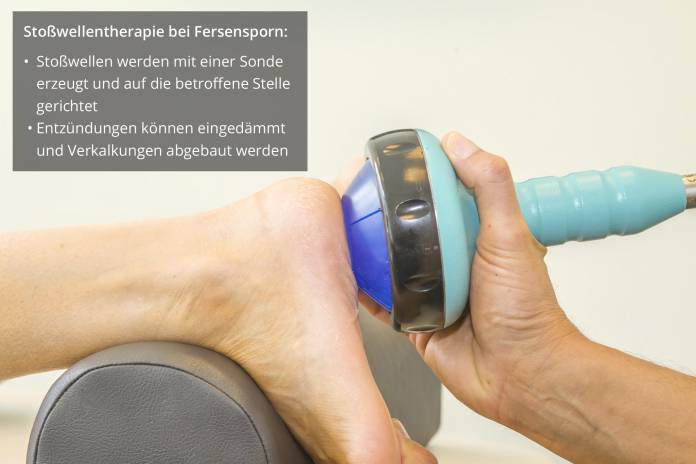Fersensporn Stoßwellentherapie