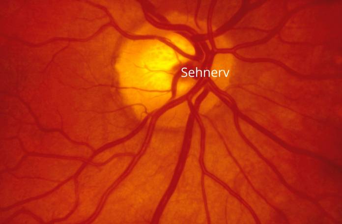 Fundus-Fotografie