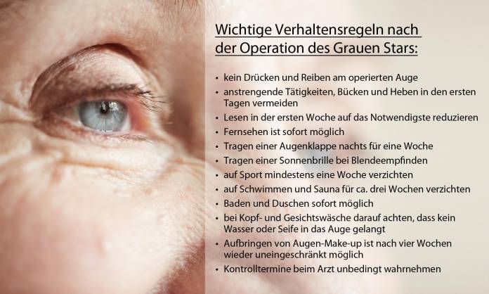 Verhaltensregeln nach der Katarakt-Operation