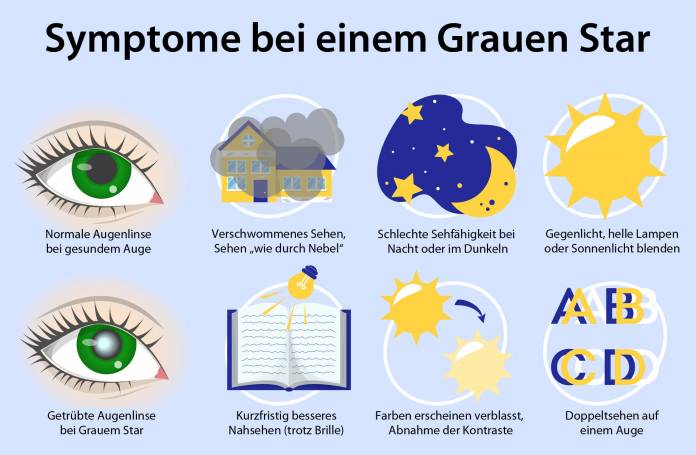 Symptome bei einem Grauen Star