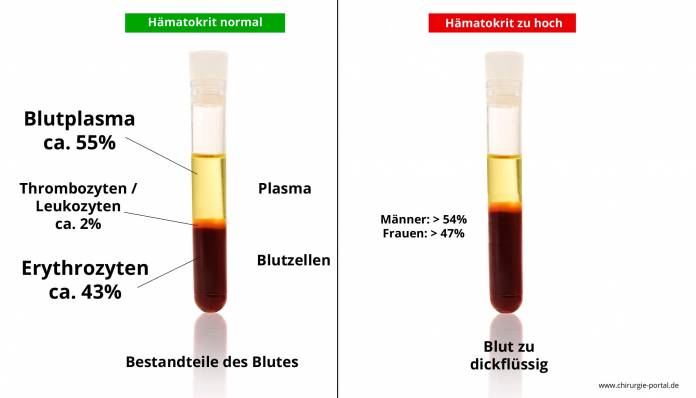 Hämatokrit zu hoch