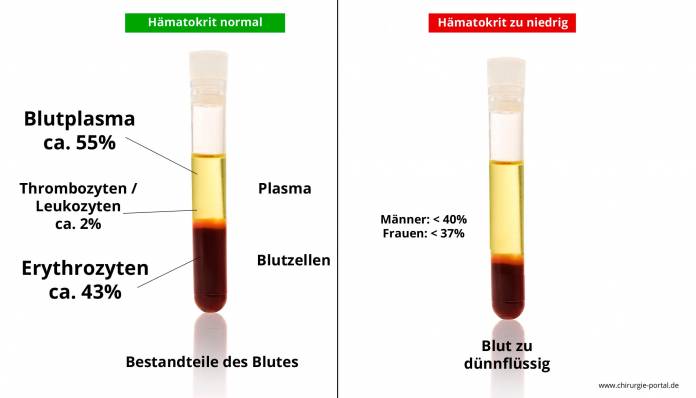 Hämatokrit zu niedrig