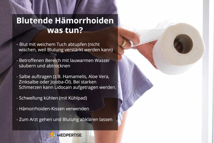 Hämorrhoiden bluten - was tun?