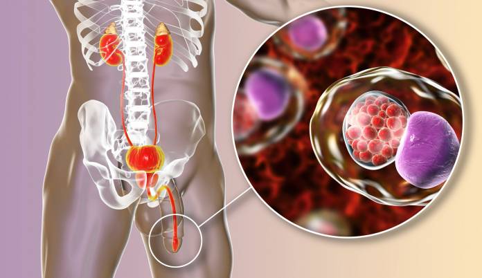 urethritis symptome