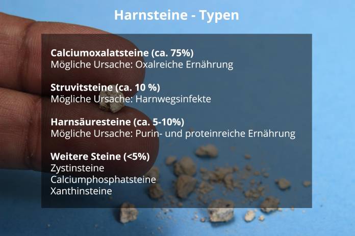 Typen von Harnsteinen