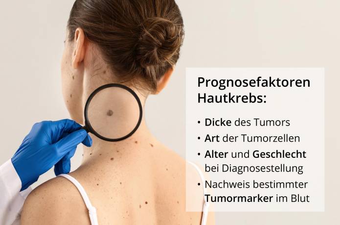 Hautkrebs Prognose