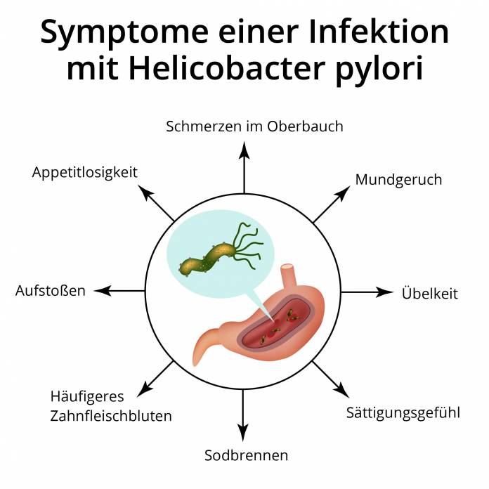 Symptome einer Infektion mit Helicobacter pylori