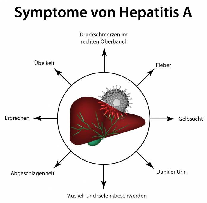 Symptome von Hepatitis A