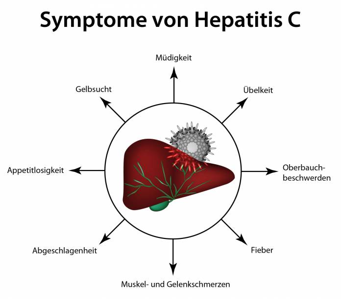 Symptome des Hepatitis C