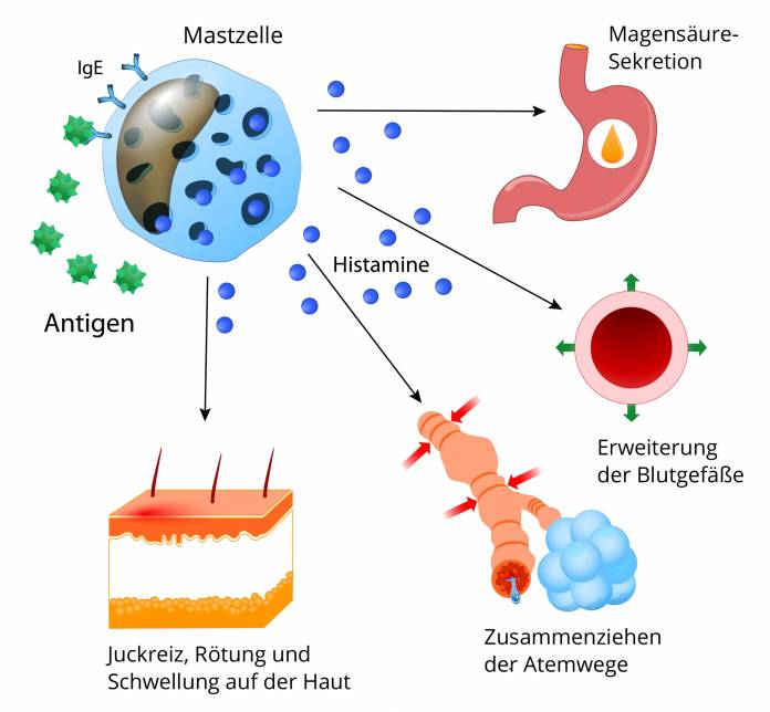 Ausschüttung von Histaminen