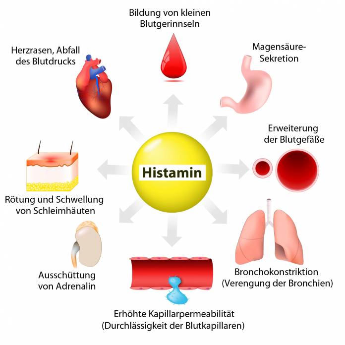 Histamin Symptome