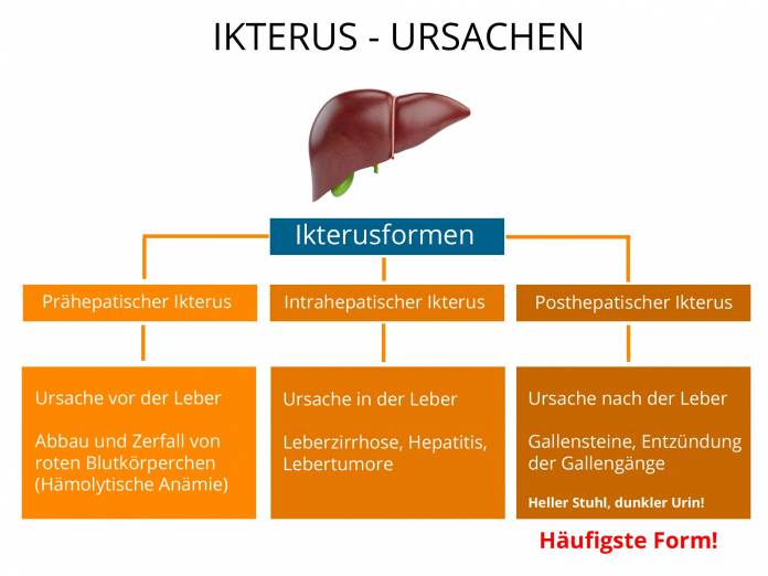 Ikterus (Gelbsucht)