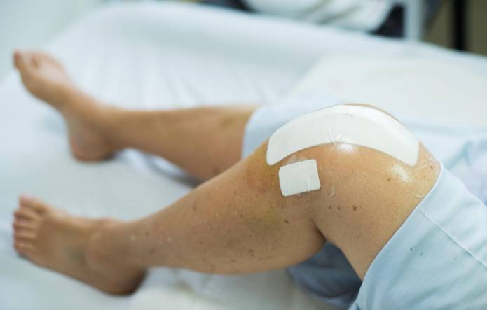 Knie krank lange schlittenprothese wie Knorpeltransplantation; Ablauf,