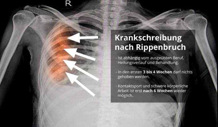 Krankschreibung nach Rippenbruch