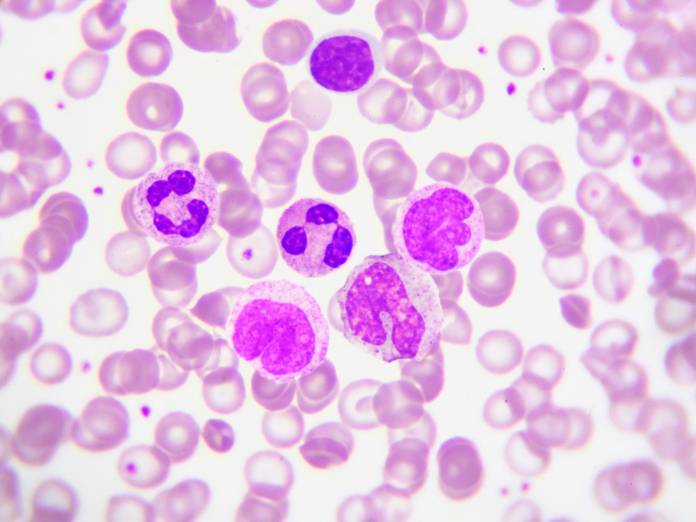 Weiße Blutkörperchen (Leukozyten) unter dem Mkroskop