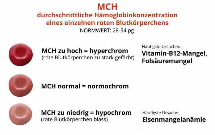 MCH