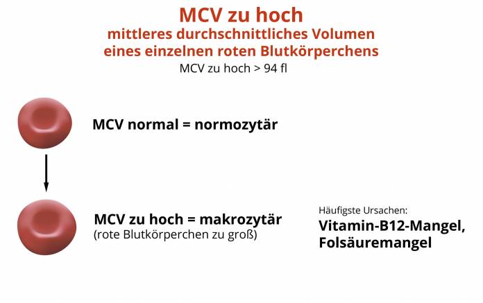 MCV zu hoch