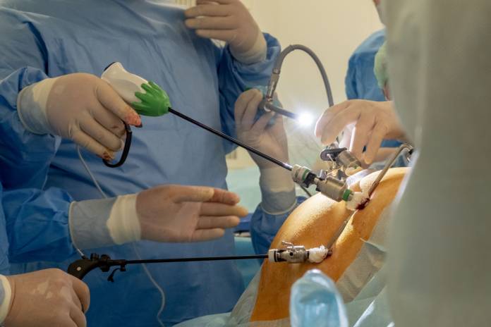 Minimalinvasive Operation von Lebermetastasen