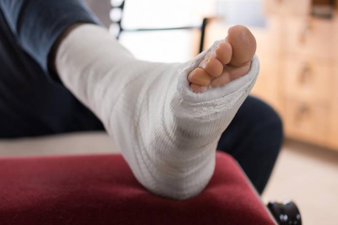 Gipsschiene fuss Behandlung im
