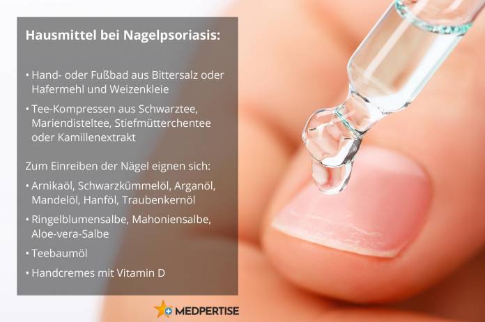 Hausmittel bei Nagelpsoriasis