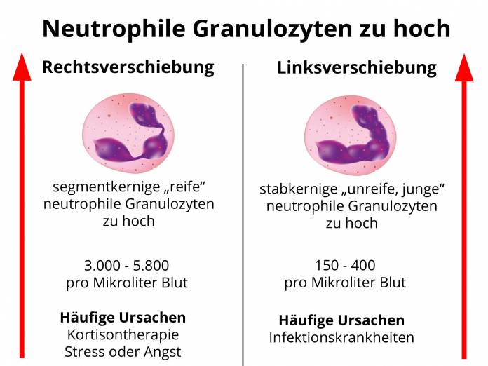 Neutrophile Granulozyten zu hoch