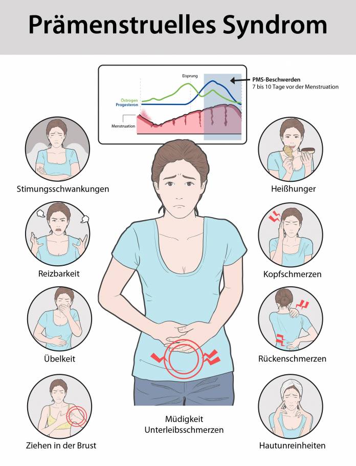 Prämenstruelles Syndrom (PMS)