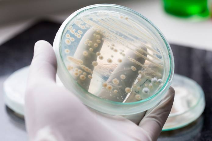 Pilz Oder Bakterien Scheide Test www.medpertise.de