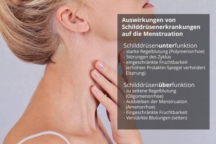 Auswirkungen der Schilddrüse auf die Menstruation
