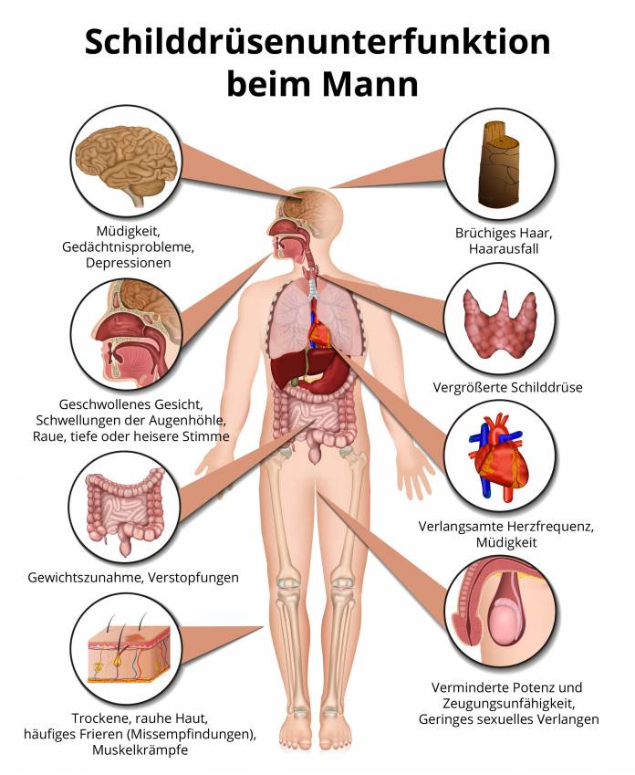 Schilddrüsenunterfunktion beim Mann