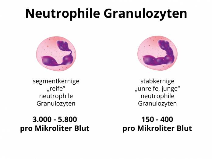 Unterschied zwischen segmentkernigen und stabkernigen neutrophilen Granulozyten