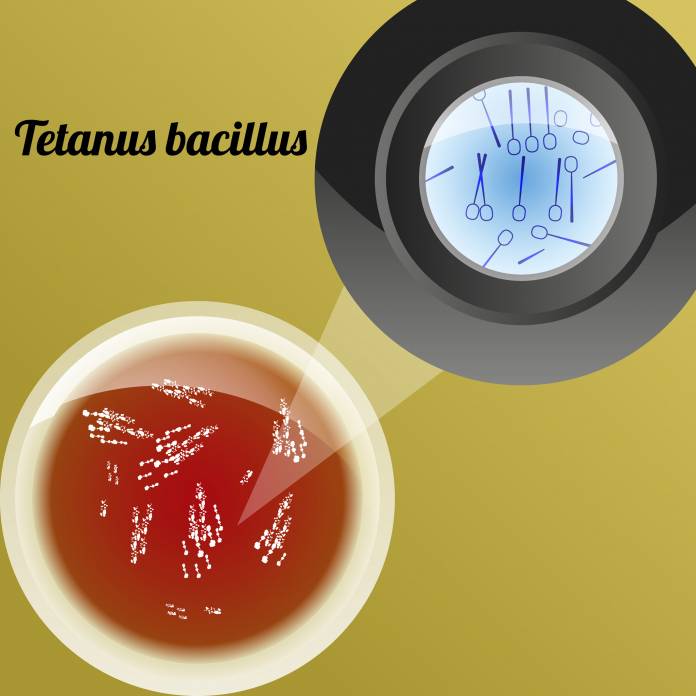 Bakterium Clostridium tetani