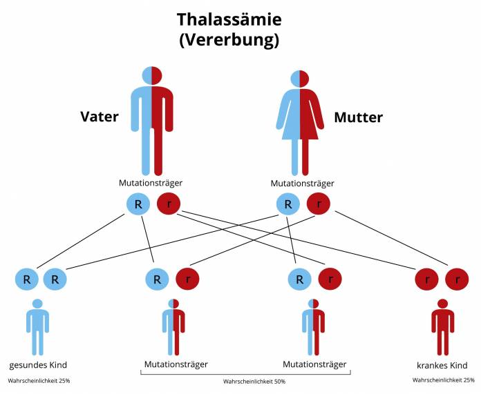 Thalassämie Ursachen