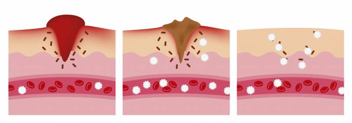 Thrombozyten Blutstillung