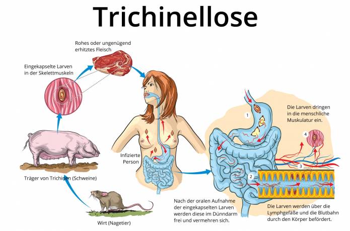 Trichinellose