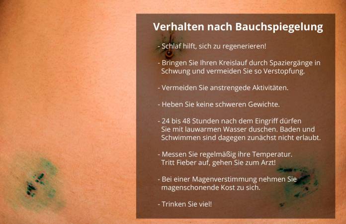 Verhalten nach Bauchspiegelung