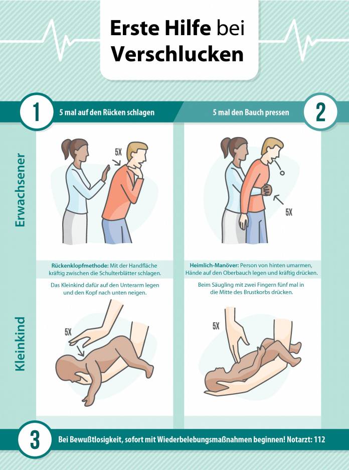 Erste Hilfe bei Verschlucken