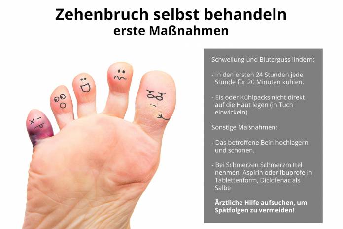 Zehenbruch selbst behandeln